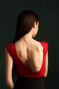 Young woman with scoliosis in dance leotard