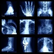 X-rays for diagnosing