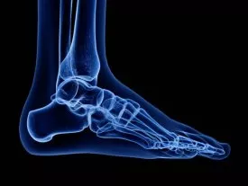 Ankle Instability