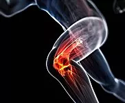 MCL Knee Injury