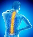 Spinal Rigidity