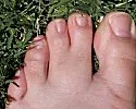 Webbed Toes