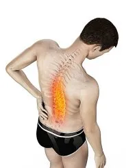 Pars Interarticularis Defect